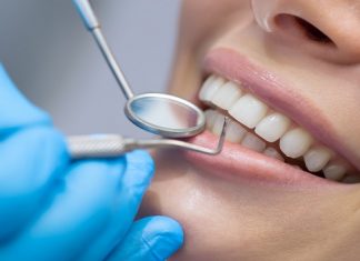 دندان عقل دندانپزشک