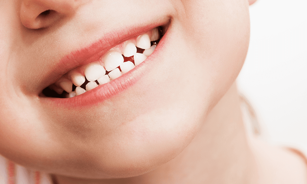 وقتی دندان‌های شیری فرزندتان را هر روز مسواک نمی‌زنید چه اتفاقی می‌افتد؟
