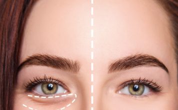 چگونه برای همیشه از شر سیاهی دور چشم خلاص شویم چگونه برای همیشه از شر سیاهی دور چشم خلاص شویم